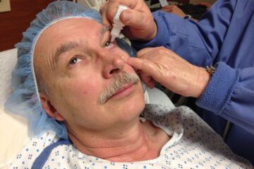 cataract surgery