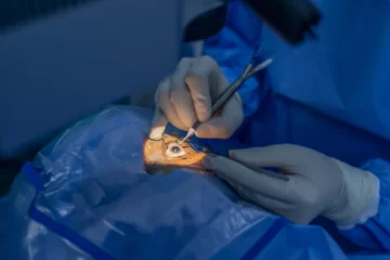 LASIK Eye Surgery